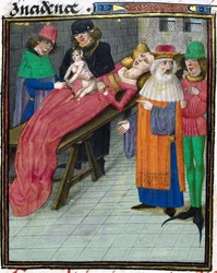 Medieval Depiction of Caesarian Birth